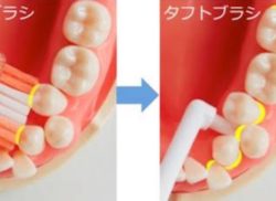 磨きやすい歯ブラシ