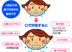 口呼吸