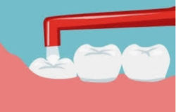 歯磨きポイント(小学生低学年)