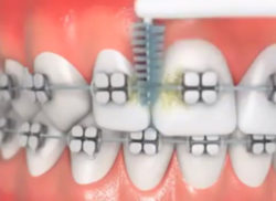 歯ブラシ＋アイテム