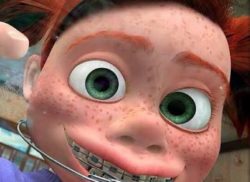 矯正中のお痛みについて