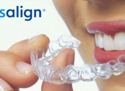 インビザライン